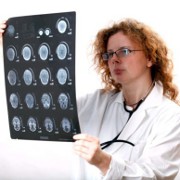 Anoxic Brain Injury related image